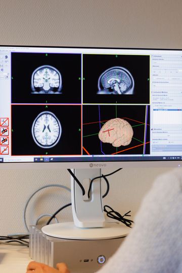 ECT psychiater en verpleegkundige B kijken naar scans